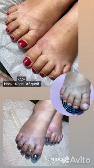 Услуги маникюра и педикюра