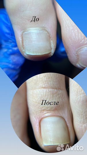 Маникюр/педикюр/наращивание