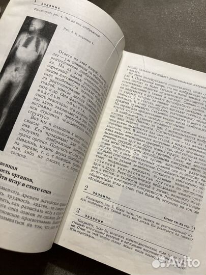 Медицинская рентгенология, Линденбратен