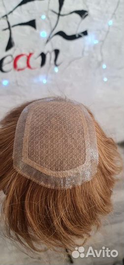 Перефиксация системы замещения волос