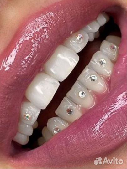 Установка Скайсов