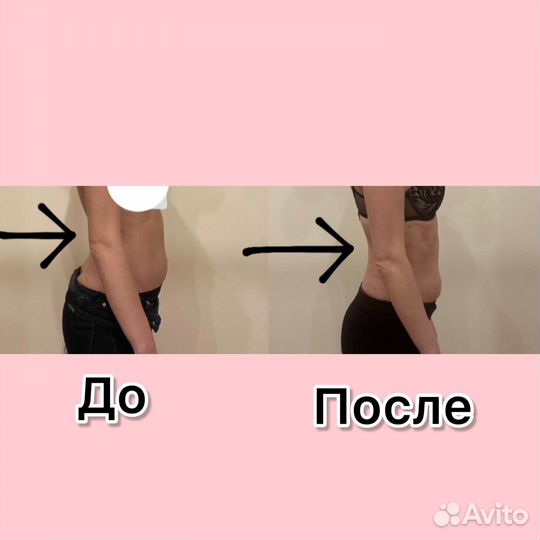 Массаж коррекция фигуры массажем