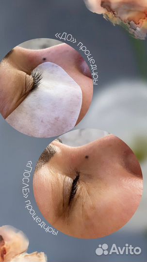 Ламинирование ресниц