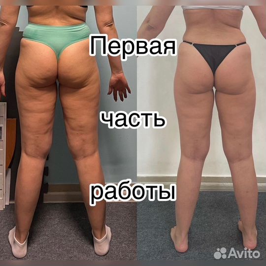 Антицеллюлитный и Классический Массаж
