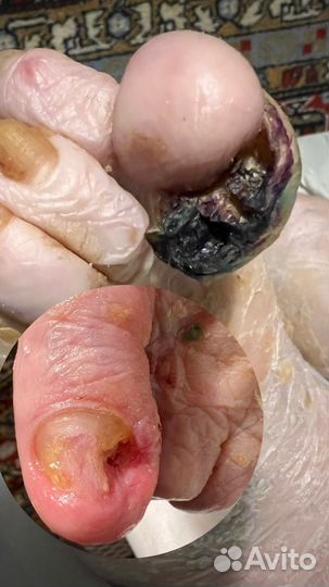 Подолог/педикюр для пожилых людей