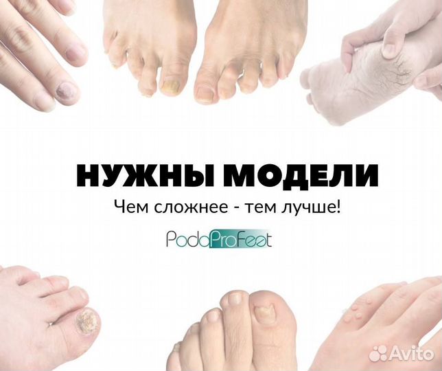 Педикюр вросший ноготь