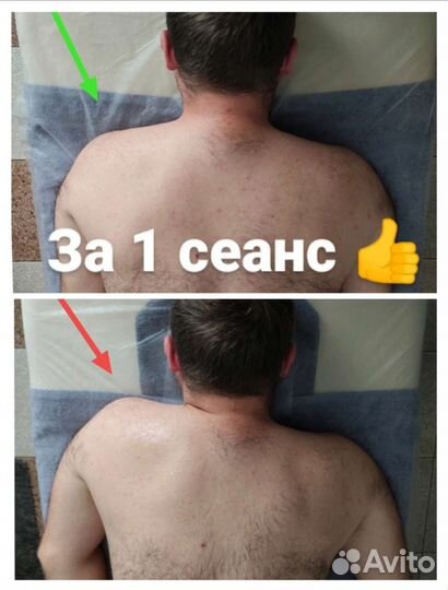 Массажист Костоправ Реабилитолог