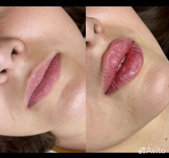 Требуются модели на всю контурную пластику