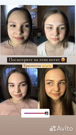 Косметолог брови чистка пилинг дермопен