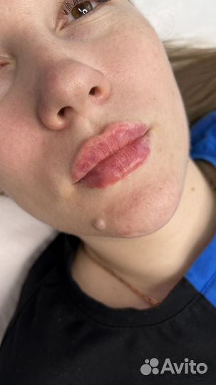 Услуги косметолога