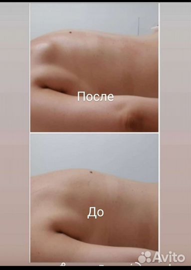 Лечебный массаж