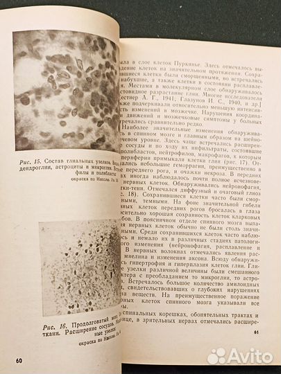 Клещевой энцефаломиелит. Шаповал. 1980