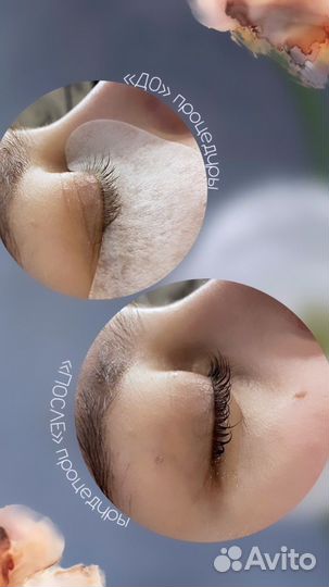 Ламинирование ресниц