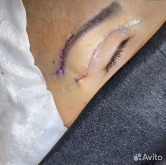 Булхорн броулифтинг