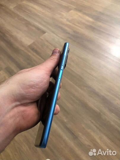 Xiaomi redmi 10