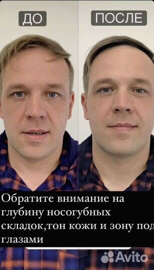 Массаж лица