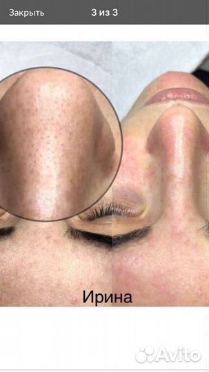 Массаж Депиляция Косметология