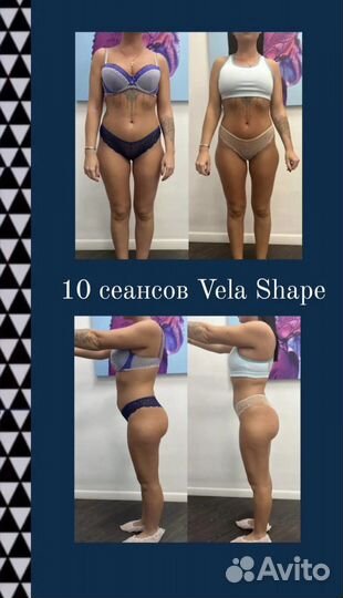 Массаж Vela Shape (LPG) 4 зоны 40 минут