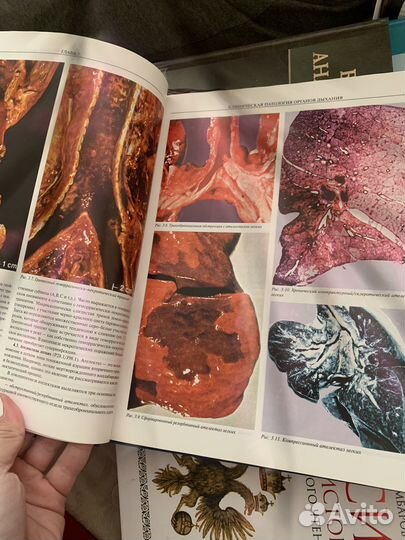 Атлас микроскопической патологии человека