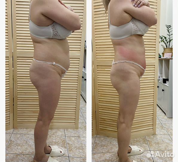 Требуется модель для похудения