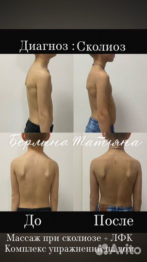 Детский массаж / ЛФК / Электрофорез