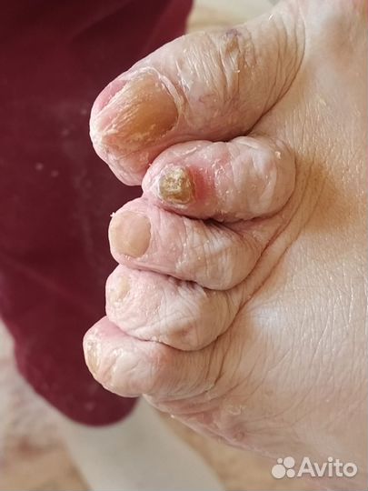 Услуги подолога