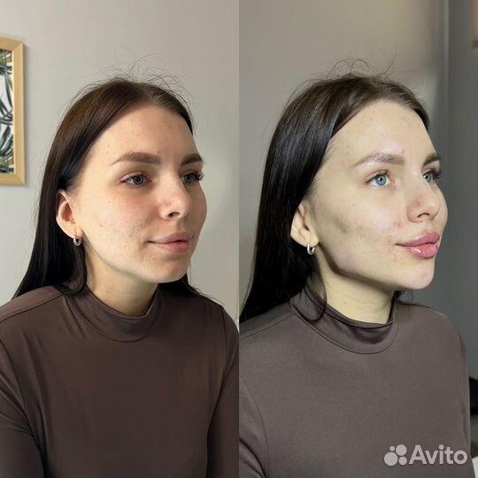Требуются модели на нити. Косметолог