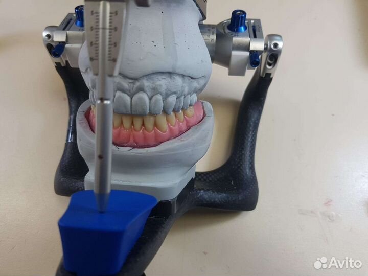 Изготовление съёмного протеза