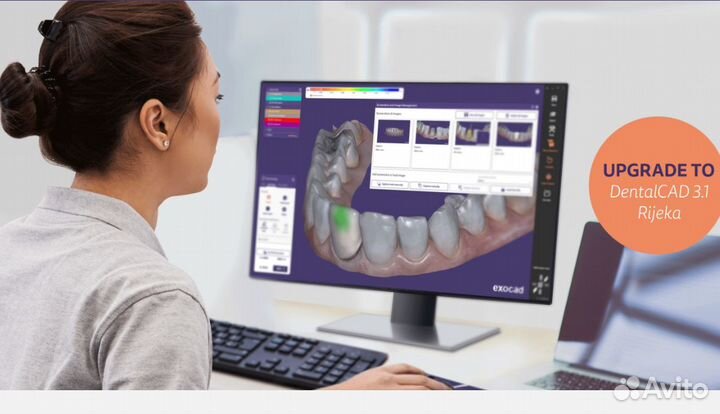 Exocad - dentalcad3.1 2022-11-10