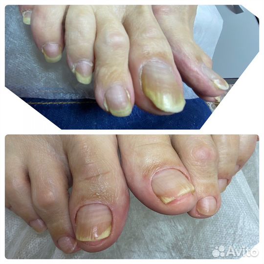 Маникюр, педикюр, наращивание ногтей