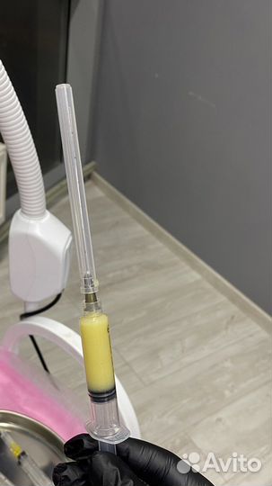 Плазмолифтинг