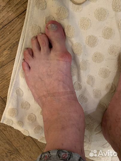 Стельки Ортопедических индивидуальные