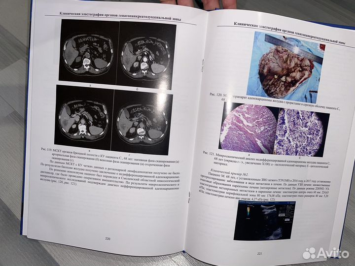 Клиническая эластография