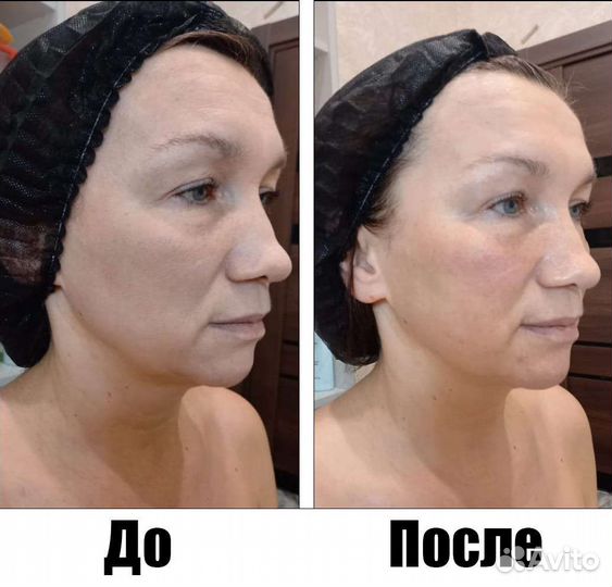 Аппаратная терапия 