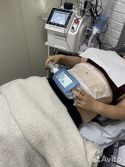 Криолиполиз RF лифтинг Кавитация Миостимуляция