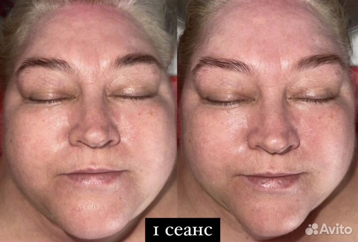 Биоэнергомассаж