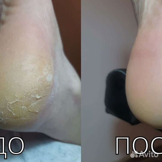 Маникюр, smart педикюр