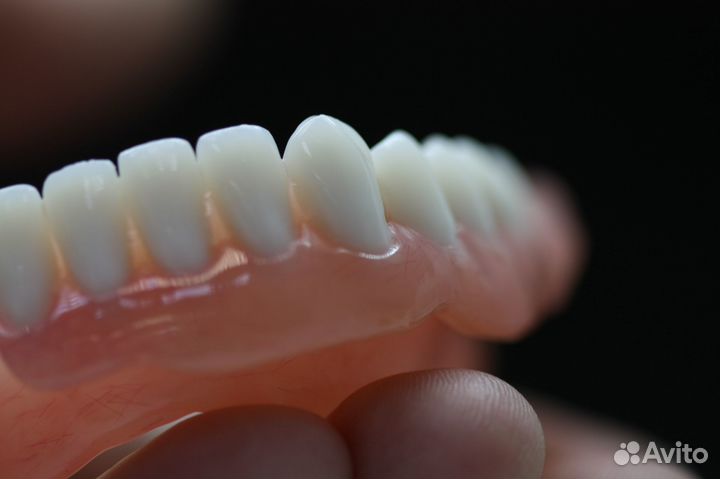 Частичный съемный протез