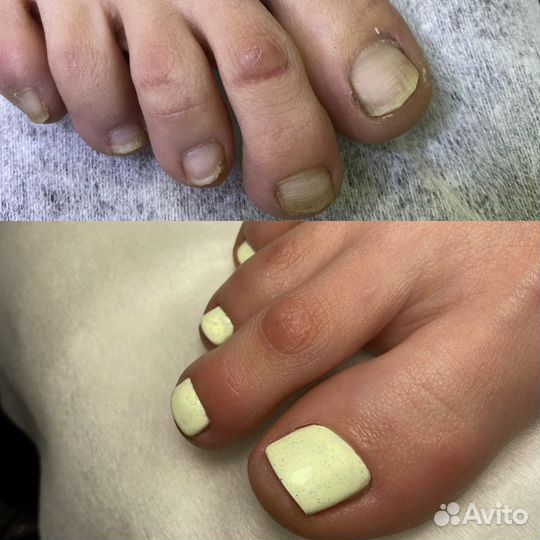 Педикюр на дому, педикюр с покрытием