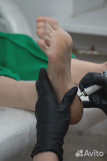 Аппаратный педикюр Обработка пальцев гель лак