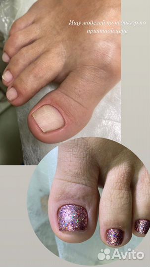 Педикюр с покрытием гель-лаком