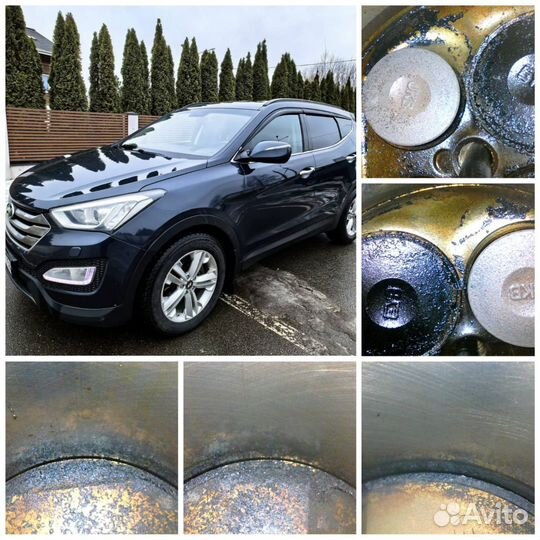 Замер компрессии/Эндоскопия с выездом