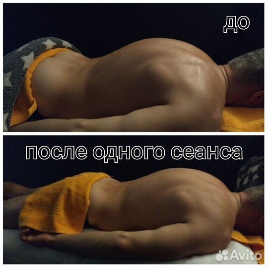 Реабилитация, массаж