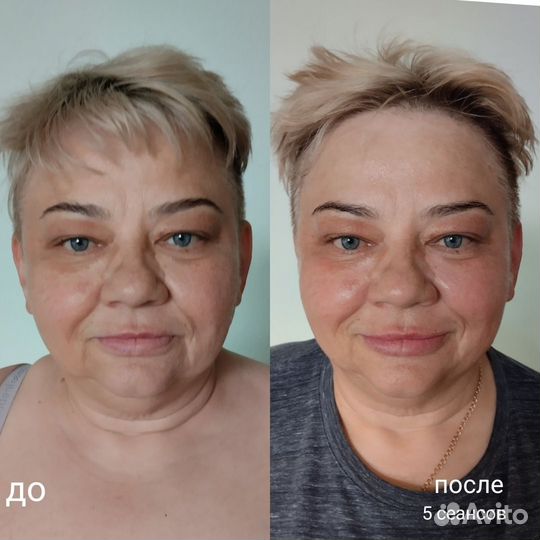 Массаж лица. Массаж для женщин