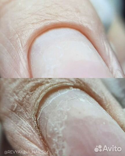 Маникюр/Smart-педикюр