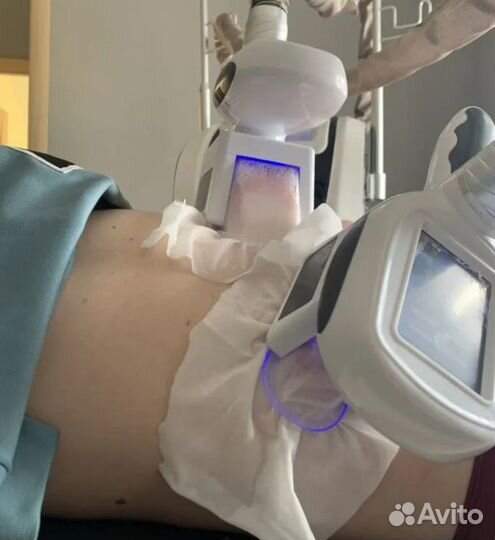 Плоский живот - размер за 1 процедуру