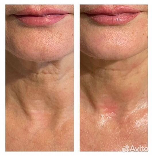 Водорослевая маска для лица