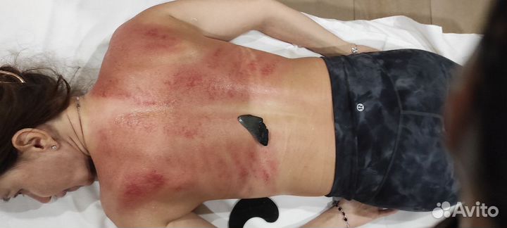 Массаж гуаша