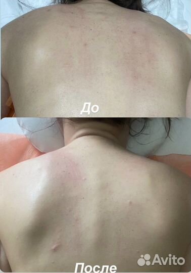 Услуги массажиста