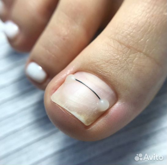 Модель на медицинский педикюр